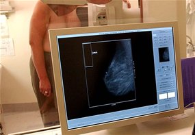 Les Tongiennes n'ont pas accès aux services de mammographie comme dans cet établissement de Melbourne. [AAP].